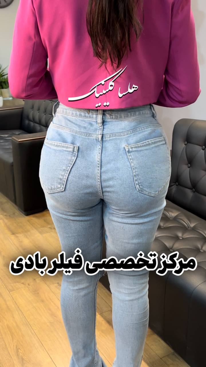 تزریق فیلر در هلسا کلینیک